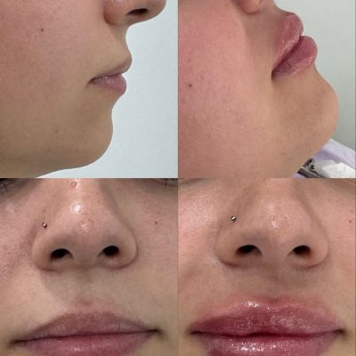 65750C70-9DE0-4819-B79C-2352F75A1C81